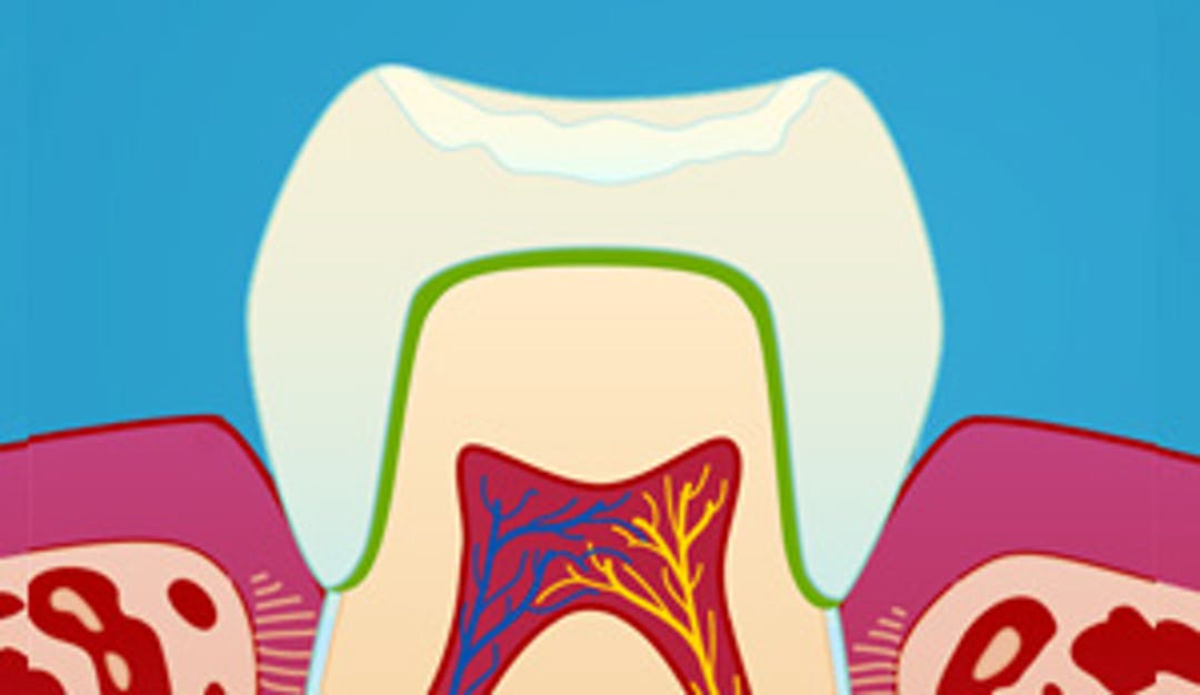 Estetisk_kroneterapi_w300-1__ade79791554be6670df8601de675f0fa-1