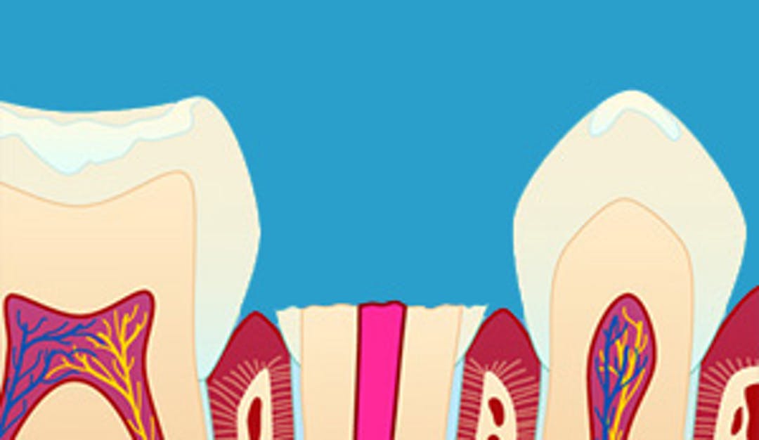 Stift_krone_w300-1__400207c605207f149d191cc94197d0ed