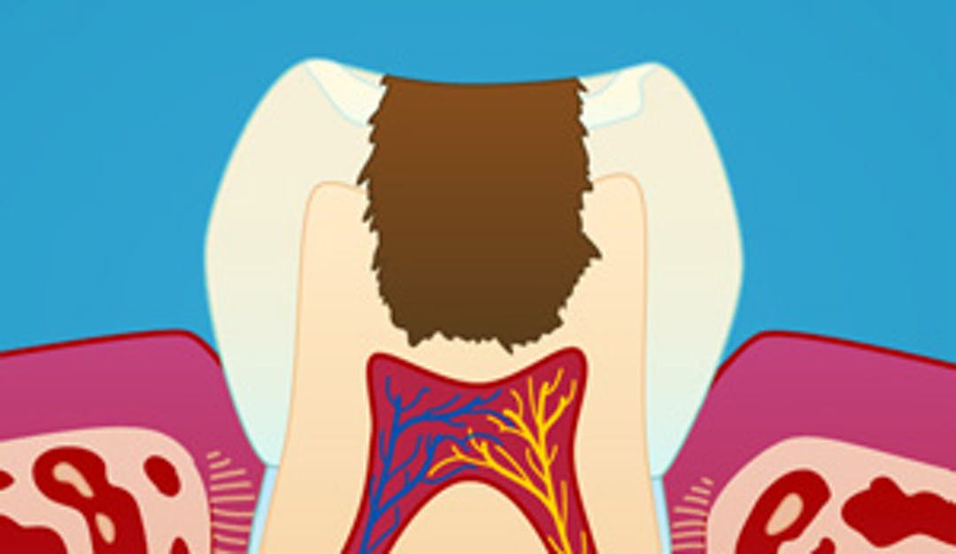 Trinnvis_ekskavering_w300__bcd68f998c3cfb98712600d5a7943340