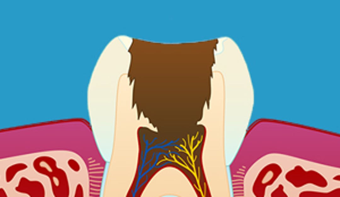 betennelse_i_nerven-_w300__fe0eaa3f3cec2c20afa5ea76355697fb-1